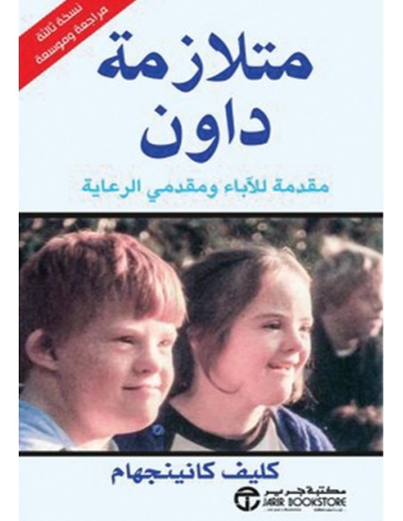 متلازمة داون